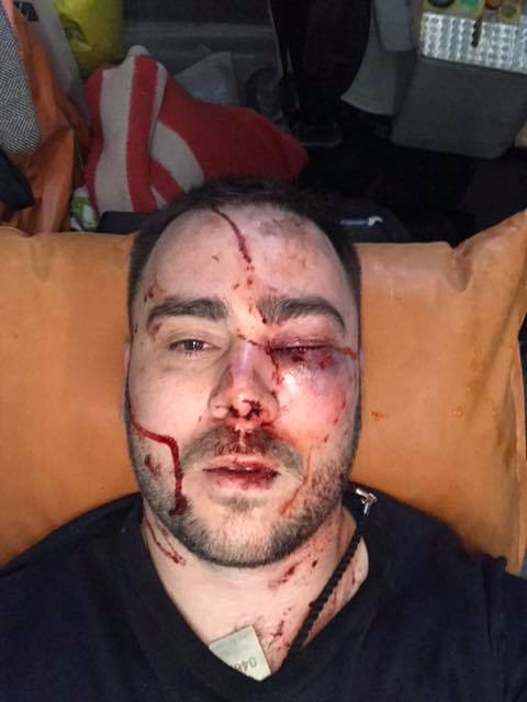 У Запоріжжі прострелили ногу активісту за зауваження не кидати петарди