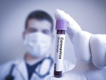 Лабораторний центр в Запоріжжі повідомив про 2 нові випадки зараження
