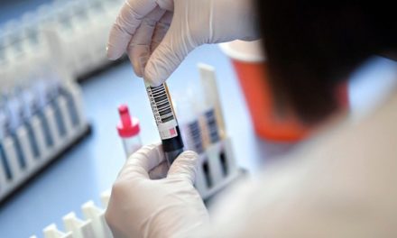 Понад пів сотні нових інфікованих коронавірусом за добу в Запоріжжя та області