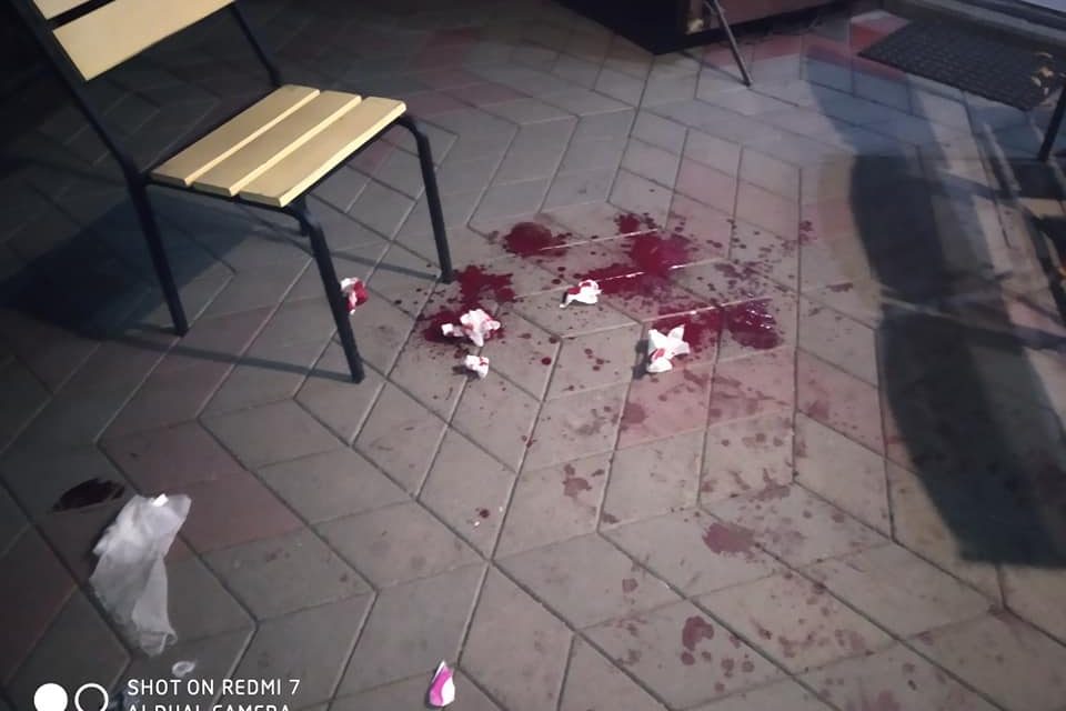 У кафе на Запоріжжі хлопець завдав важких ножових поранень відвідувачам закладу, які відмовилися його пригощати – фото