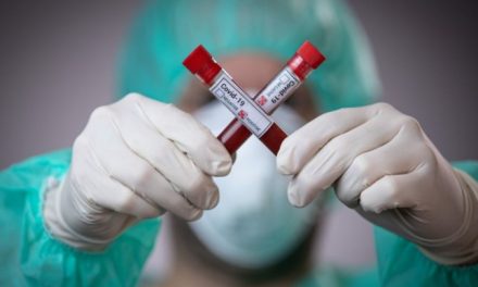 За добу в Запоріжжі та області 5 смертей від коронавірусу, 140 нових випадків