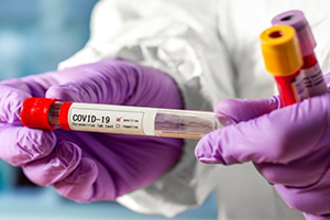 У Запорізькій області 85 нових випадків захворювання на COVID-19