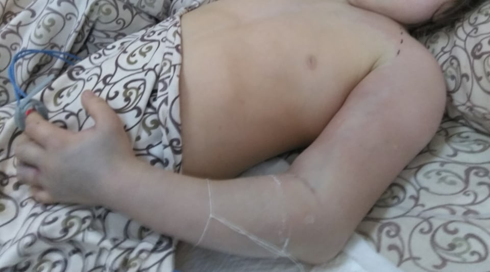 Медики у Запоріжжі сьогодні прооперували дівчинку, яку на Великдень вкусила гадюка