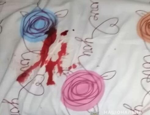 На Київщині невідомий чоловік пробрався до кімнати та наніс тілесні й ножові поранення дітям – фото