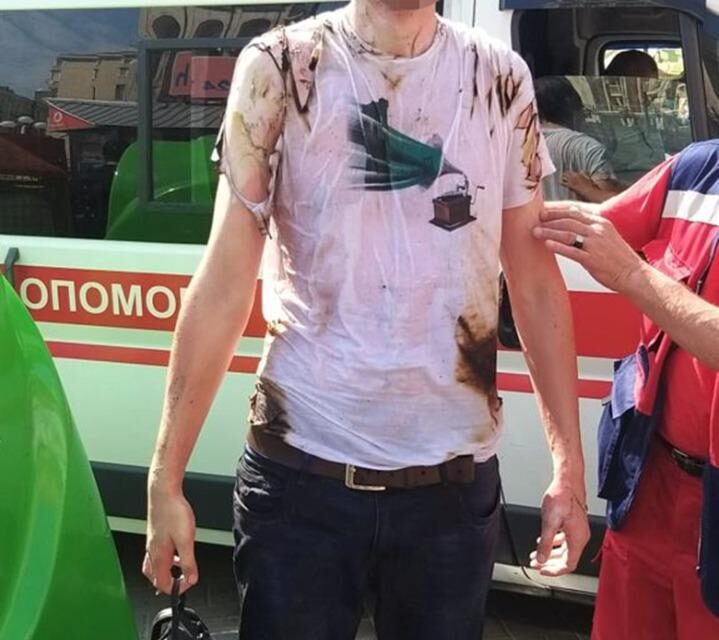 У центрі Києва молодик хотів вчинити самоспалення