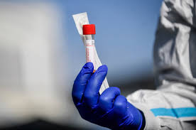 За минулу добу від коронавірусу в Запорізькій області померло 5 людей
